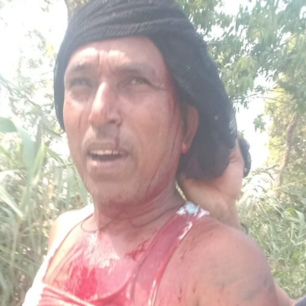 आजमगढ़ में दो पक्ष भिड़े:होली पर रंग डालने को हुआ झगड़ा, दो को अस्पताल में कराया भर्ती