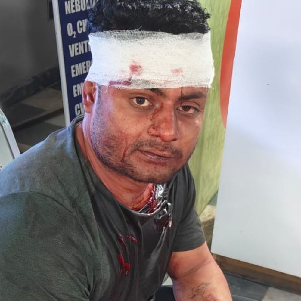 मामूली कहासुनी पर युवक पर बांके से हमला:गर्दन पर लगी गहरी चोटें, सीसीटीवी में कैद हुआ बांका मारते आरोपी