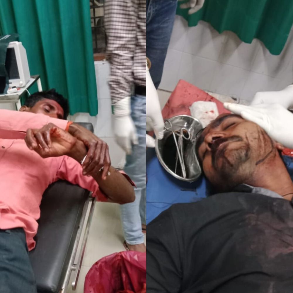 अयोध्या में लेग पीस को लेकर 3 युवकों में मारपीट:दो की हालत गंभीर, मेडिकल कॉलेज रेफर, पुलिस जांच में जुटी