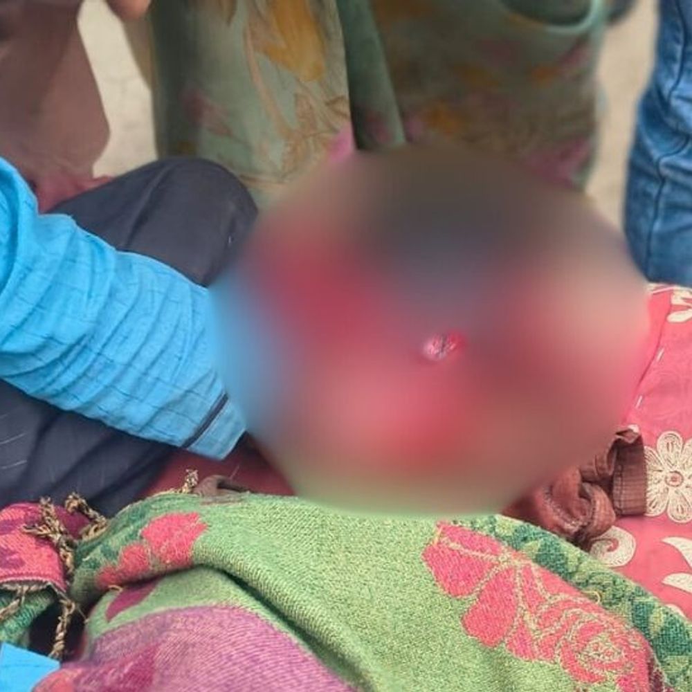 बहराइच में 7 वर्षीय बच्ची पर तेंदुए का हमला:5 से 7 मीटर तक घसीटा, झाड़ियों से निकलकर बच्ची पर झपट्टा, हालत गंभीर