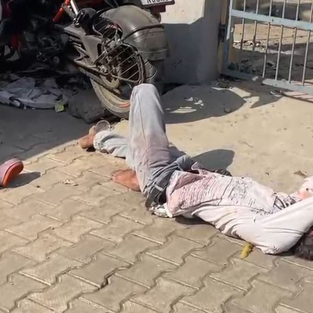 होली पर रफ्तार का कहर, हादसों में 12 लोग घायल:गंभीर हालत में तीन रेफर, बाइकों की भिड़ंत, तेज रफ्तार कार ने मारी टक्कर