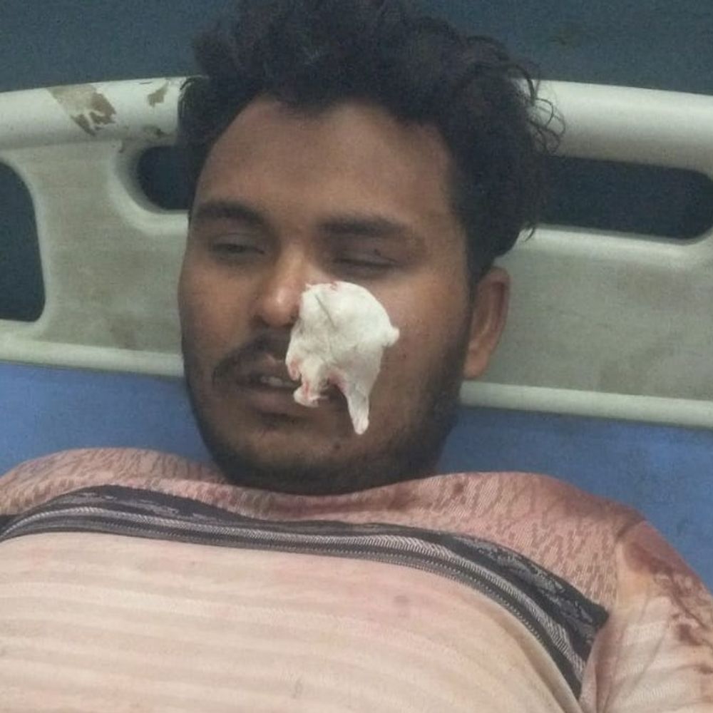 शिकारपुर में होली पर युवती से छेड़छाड़, भाई को पीटा:बीच-बचाव करने आए ग्रामीण से भी मारपीट, 6 आरोपी हिरासत में