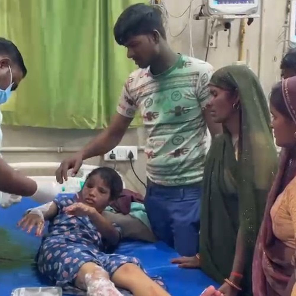 गर्म तेल की कड़ाही गिरने से महिला झुलसी:फर्रुखाबाद में खाना बनाते समय हादसा, लोहिया अस्पताल से रेफर