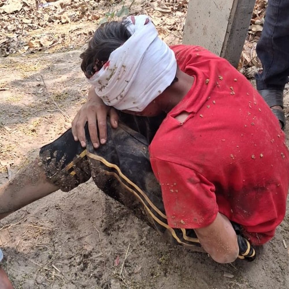 सिद्धार्थनगर के बांसी-धानी मार्ग पर कार-बाइक टक्कर:दो नाबालिग गंभीर रूप से घायल, पुलिस ने कार कब्जे में ली