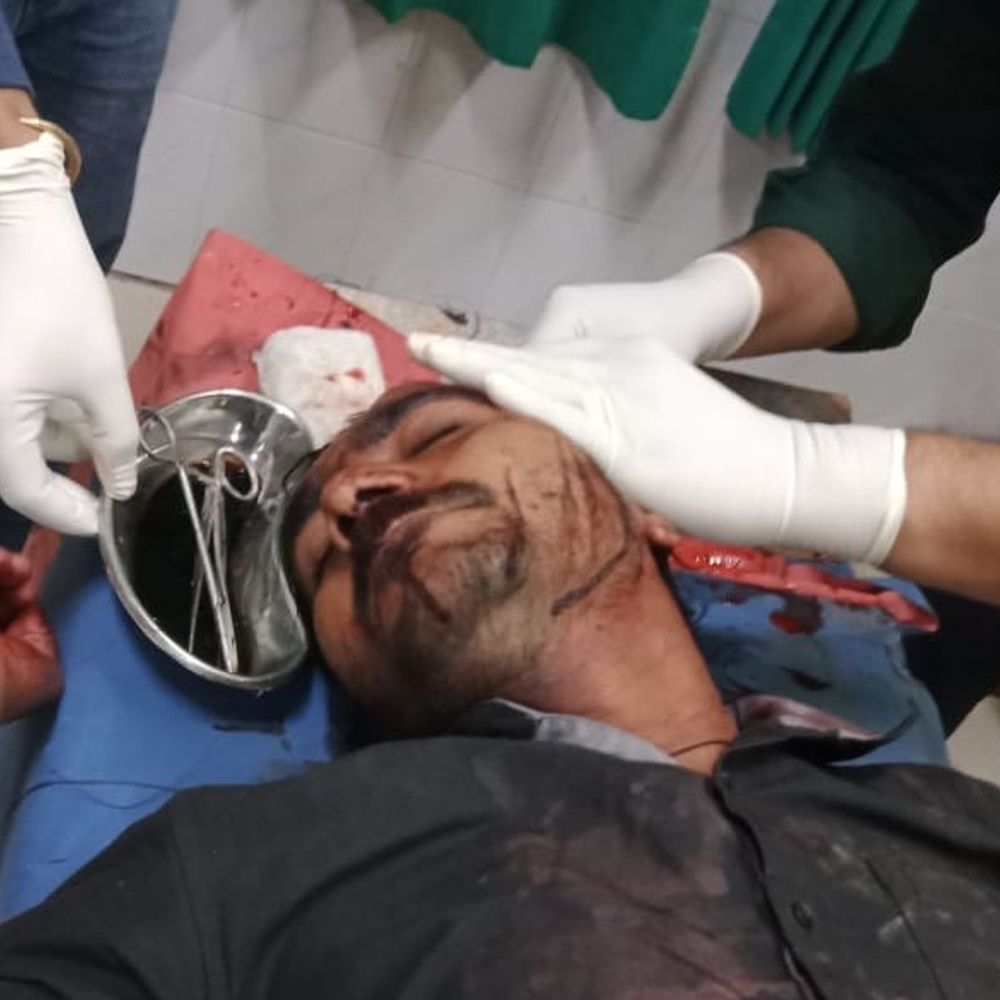 अयोध्या में मुर्गे के लेग पीस को लेकर विवाद:लाठी-डंडे चले, 3 घायल; एक पर केस दर्ज