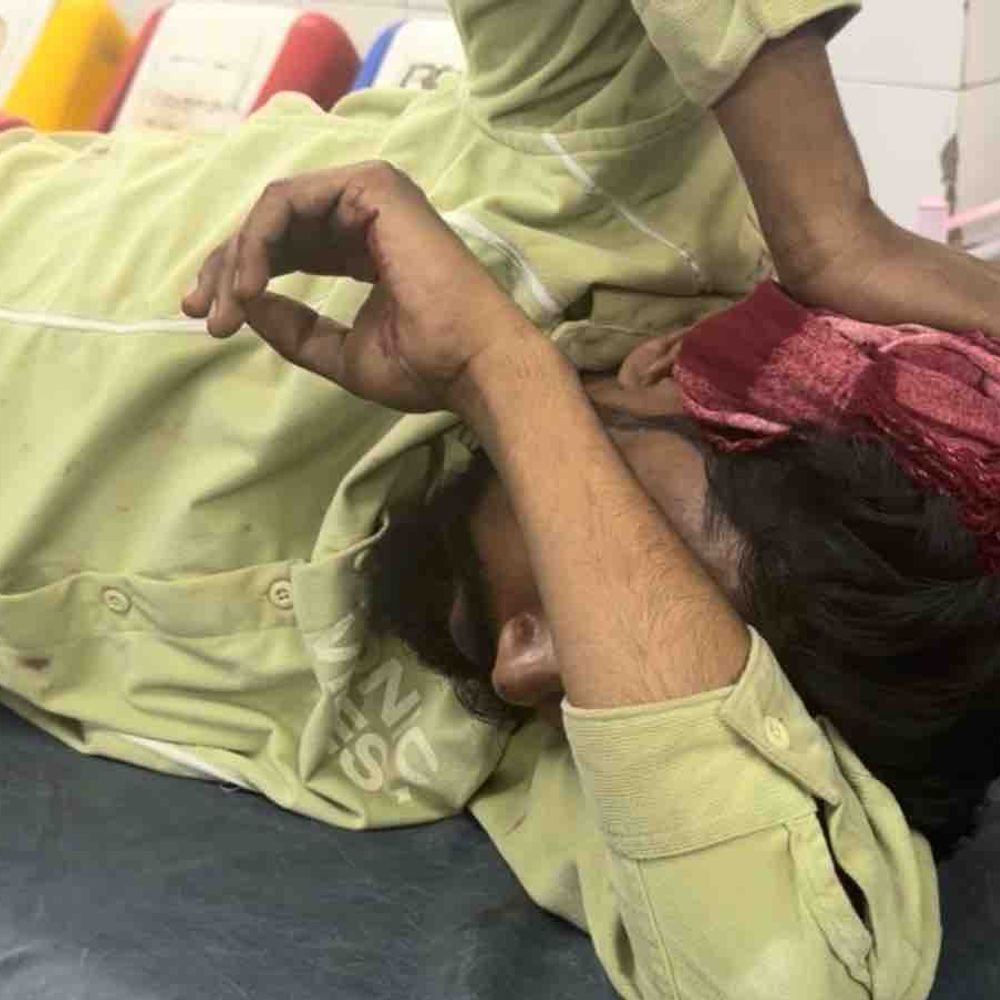 रामपुर में बिजली तार विवाद में महिला पर हमला,:हाथ-पैर टूटे, दो बेटे गंभीर घायल; पुलिस जांच में जुटी