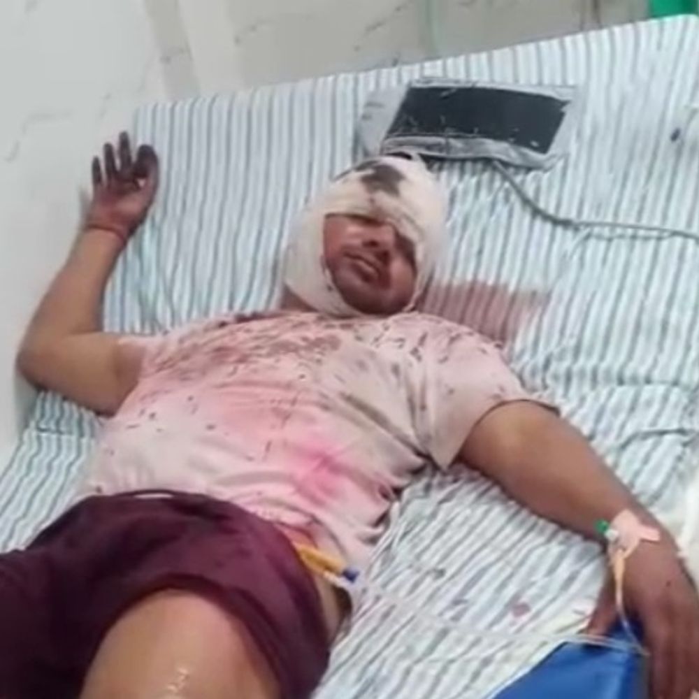 होली के बाद देवरिया में बढ़े हादसे:अस्पतालों में 322 से अधिक मरीज भर्ती, 13 शव पोस्टमार्टम हाउस पहुंचे