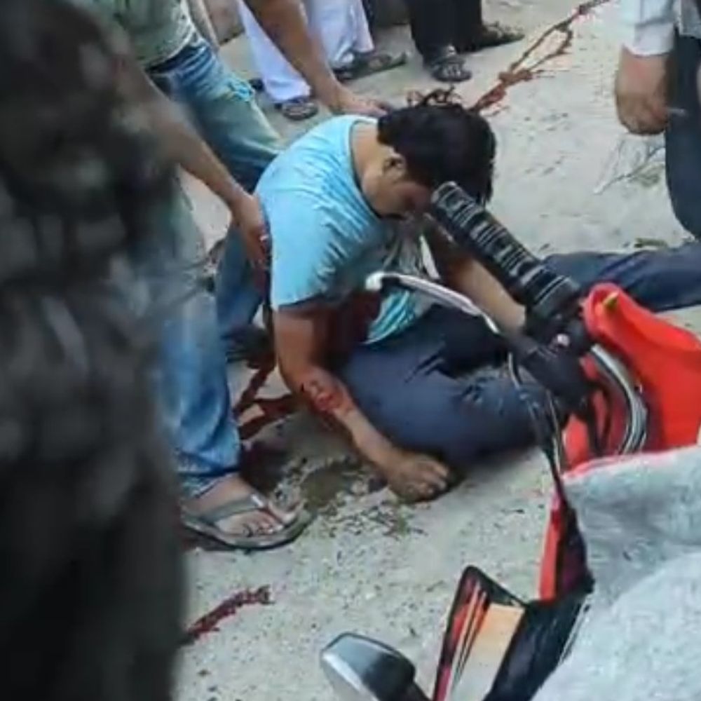 झांसी में पूर्व पार्षद को गोली मारी:शादी के कार्ड बांटने जा रहे थे, झांसी मेडिकल कॉलेज रेफर