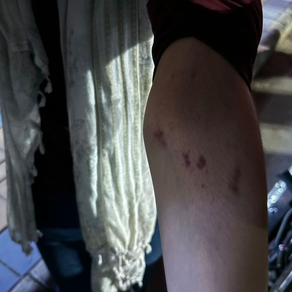 लोहिया अस्पताल में मरीज के साथ मारपीट:गलत इंजेक्शन लगाने का विरोध करने पर जड़े थप्पड़, घटना के चार घंटे बाद पहुंचे थाना प्रभारी