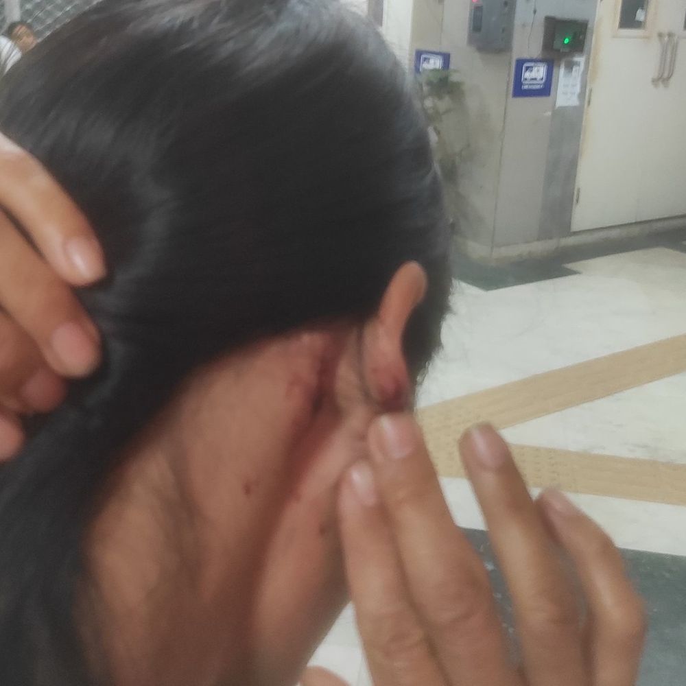 दिल्ली- मणिपुर की महिला और उसके दोस्तों से मारपीट:मेघालय CM ने पुलिस सुरक्षा पर नाराजगी जताई, पुलिस ने मुख्यमंत्री को जवाब दिया