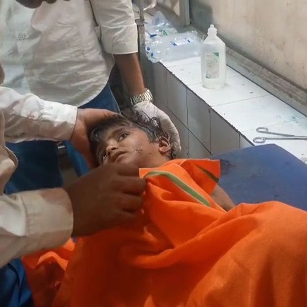 7 वर्षीय दिवंशी का लखनऊ में चल रहा इलाज:आवारा कुत्तों के हमले में गंभीर रूप से घायल हुई थी, नहीं पकड़े गए आवारा कुत्ते