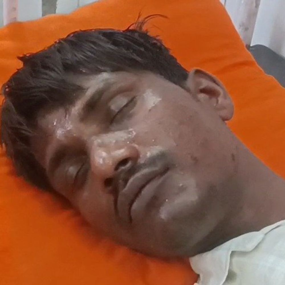 इटावा में दो पक्षों में जमकर मारपीट:ईंट-पत्थर चले, छह लोग घायल; पत्नी ने मायके में रख दिए थे जेवरात