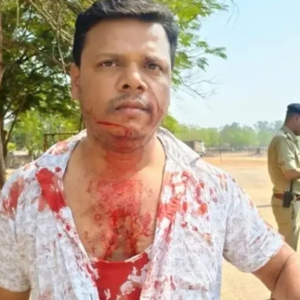 दुर्ग में सड़क हादसे में एक व्यक्ति की मौत:  तेज रफ्तार ट्रक ने लिया चपेट में, इधर रानीतराई में व्यापारी के उपर जानलेवा हमला, आरोपियों की तलाश में जुटी पुलिस – durg-bhilai News