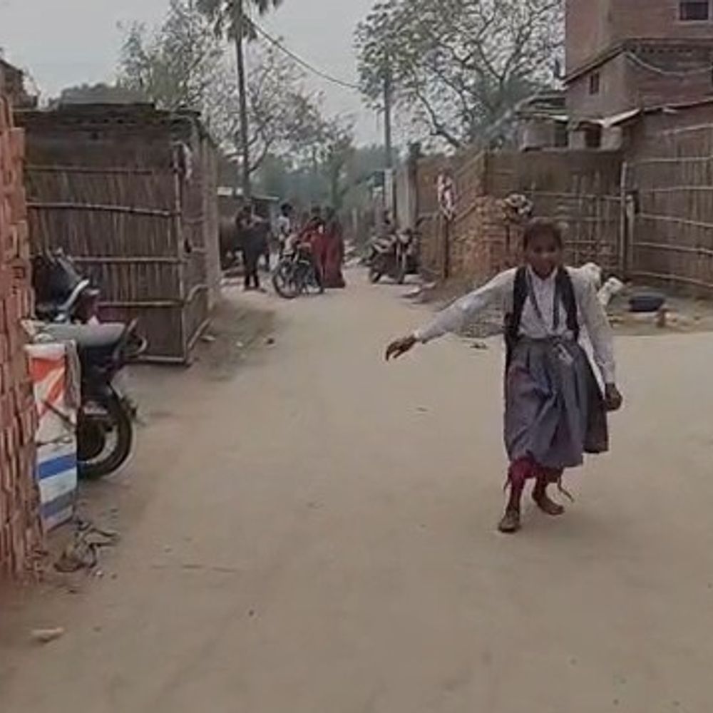 गोपालगंज में दिव्यांग छात्रा 2KM पैदल जाती है स्कूल:  ट्राईसाइकिल नहीं मिलने से परेशानी, डॉक्टर बनकर लोगों की करना चाहती है सेवा – Gopalganj News