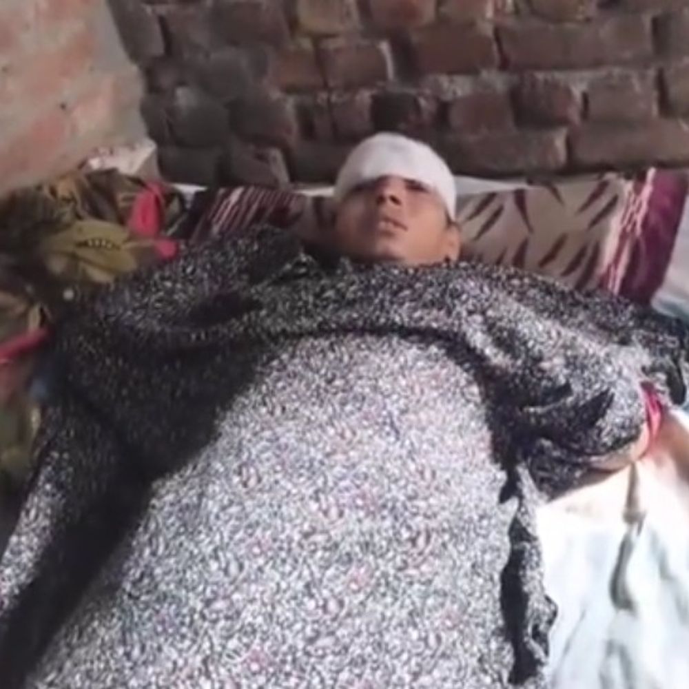 हापुड़ में बच्चों के विवाद में दो पक्षों में पथराव:दो महिलाएं घायल; पुलिस ने समझाकर शांत कराया