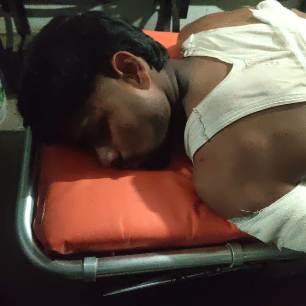 11वीं के छात्र ने इंटर छात्र को किया लहूलुहान:सुल्तानपुर में खेल के दौरान हुए विवाद में शरीर पर आए पांच जगह निशान