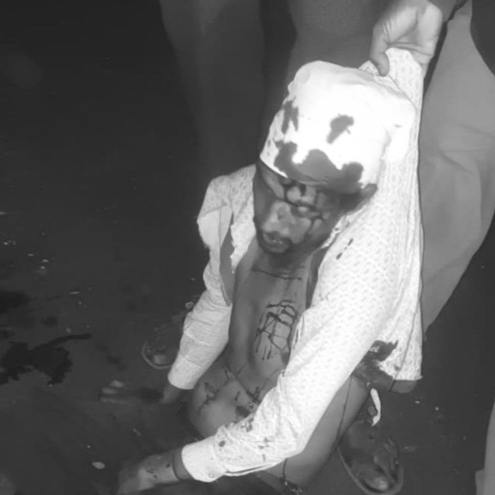 शाजापुर में वाहन की टक्कर से दो युवक गंभीर घायल:  दोनों ग्राम बड़ागांव के रहने वाले, बाइक से सफर कर रहे थे – shajapur (MP) News