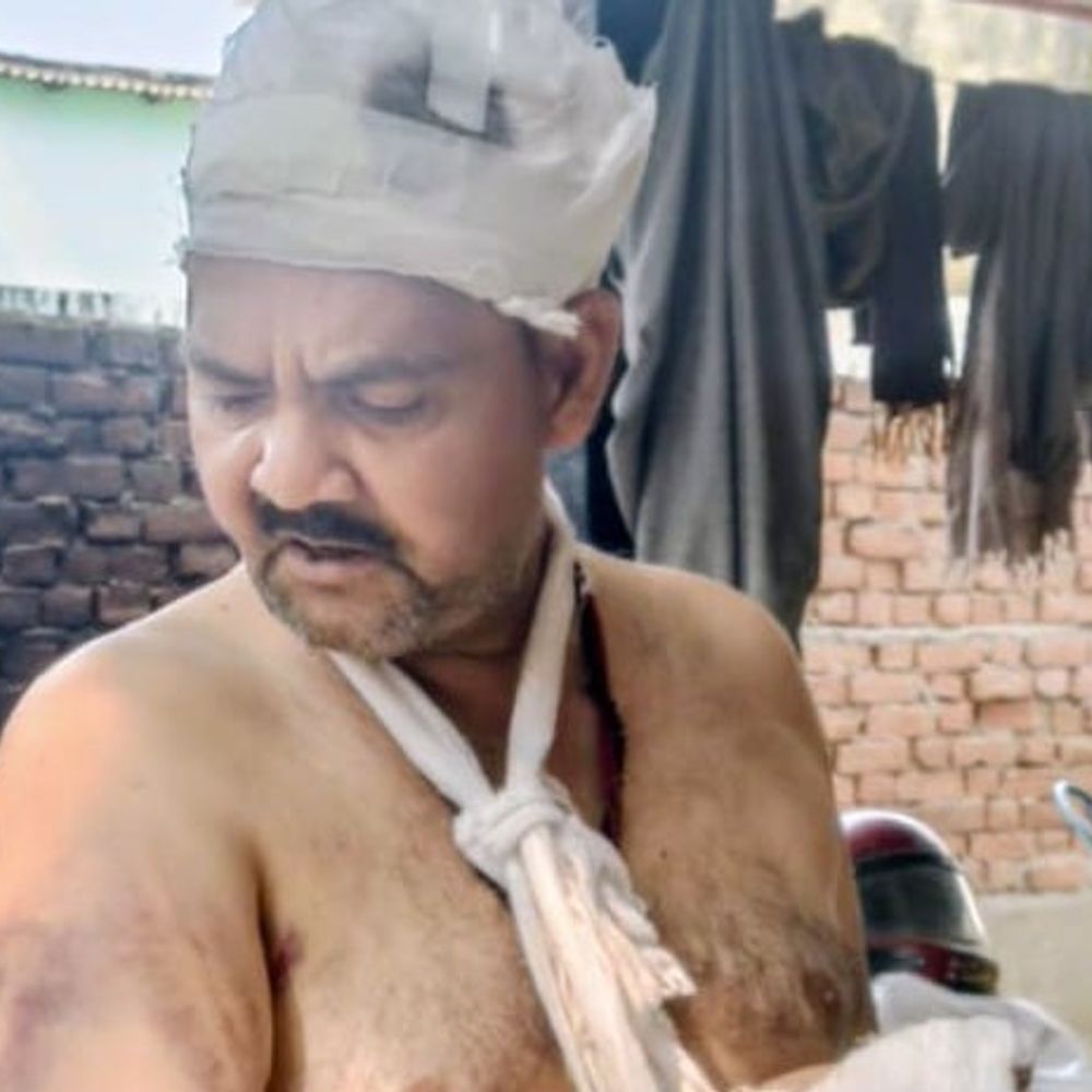 देवरिया में बेटे पर हमले के बाद दे रहे धमकी:केस दर्ज होने के बाद भी गिरफ्तारी नहीं, पिता ने एसपी से गुहार लगाई