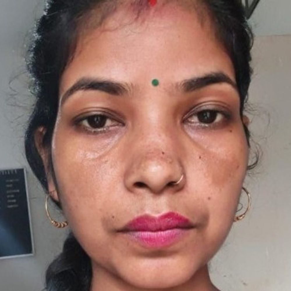 ट्रक ने बाइक को मारी टक्कर, पत्नी की मौत:बरेली में पति गंभीर घायल, शादी से लौट रहे दंपति के साथ हुआ हादसा