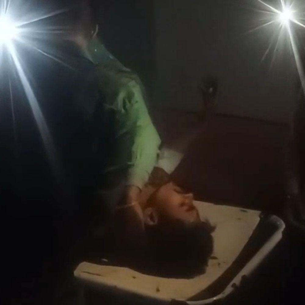 बांदा सीएचसी में मोबाइल टॉर्च से घायलों की ड्रेसिंग:वीडियो सामने आने पर सीएमओ ने जांच के आदेश दिए