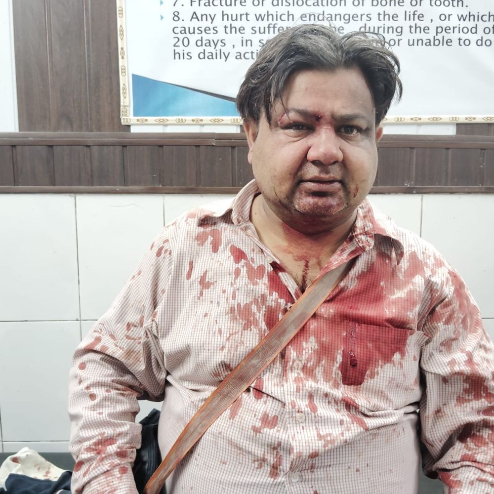 मवाना में फोटोग्राफर पर लूट के इरादे से हमला:घायल फोटोग्राफर ने किया मुकाबला, बदमाश टी-शर्ट छोड़ भागा