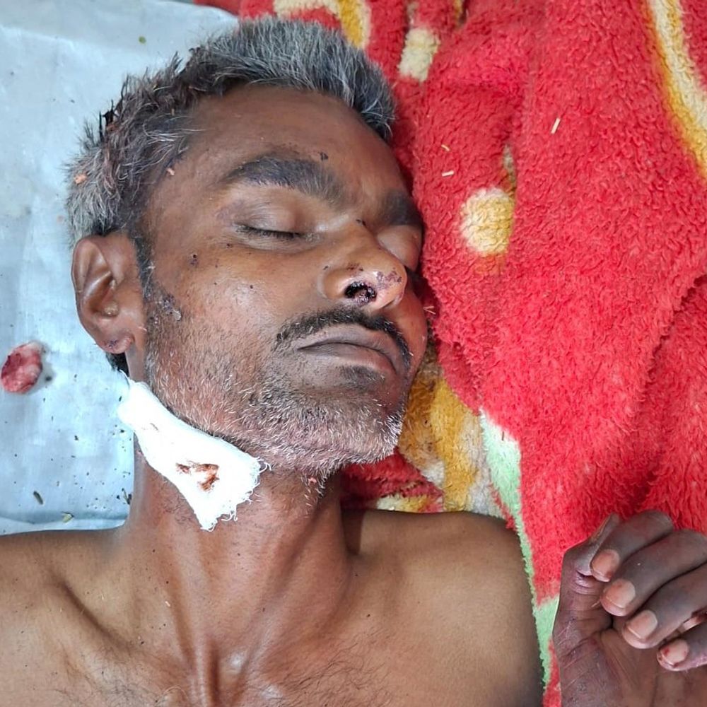 पति-पत्नी के विवाद में पति को लगी चाकू, हालत गंभीर:दरवाजे के पास खून से लथपथ मिला, पड़ोसियों ने बुलवाई एंबुलेंस