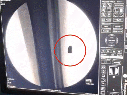 आरा में युवक पर फायरिंग मामले में FIR दर्ज:दोस्त के साथ छपरा से आया था, पूर्व के विवाद में गंगा पुल के पास बदमाशों ने मारी गोली