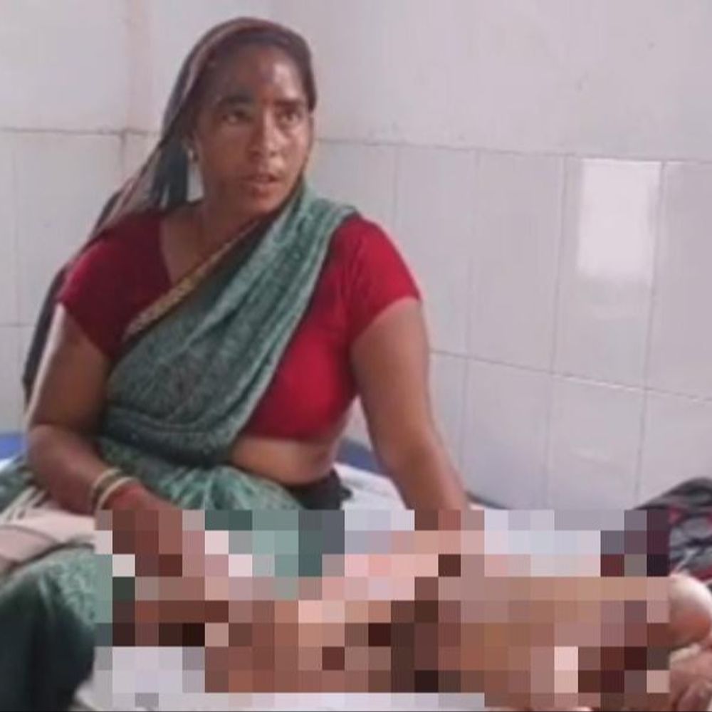 बरेली में सिलेंडर भरवाने के नहीं थे पैसे:मिट्टी के चूल्हे पर बन रहा था खाना, कुकर फटने से मासूम समेत 4 झुलसे