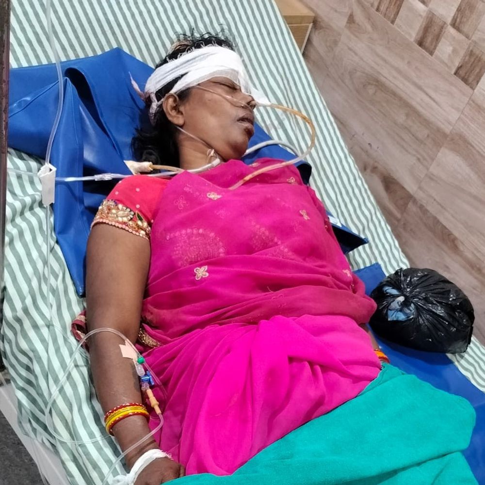 निर्माणाधीन कारागार में महिला मजदूर घायल:सिर पर ईंट गिरने से आई गंभीर चोट, गोरखपुर रेफर