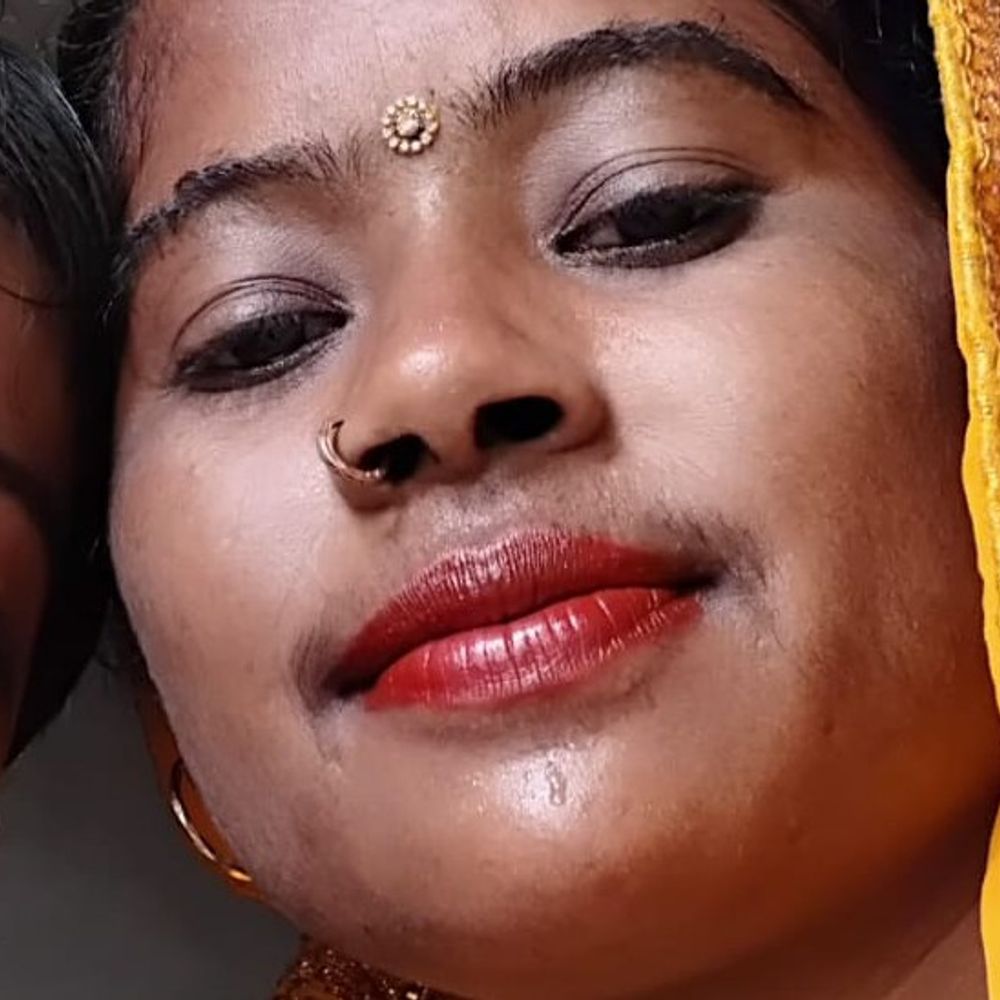 ऑपरेशन के बाद महिला की मौत:निजी अस्पताल सील, पति की तहरीर पर मुकदमा दर्ज कर जांच शुरू