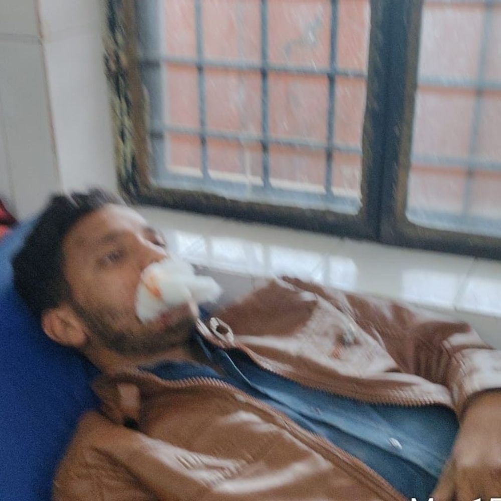 मुजफ्फरनगर में बाइकों की टक्कर, चार युवक गंभीर घायल:ईद की खरीदारी से लौटते समय तेवड़ा-चौरावाला मार्ग पर हादसा