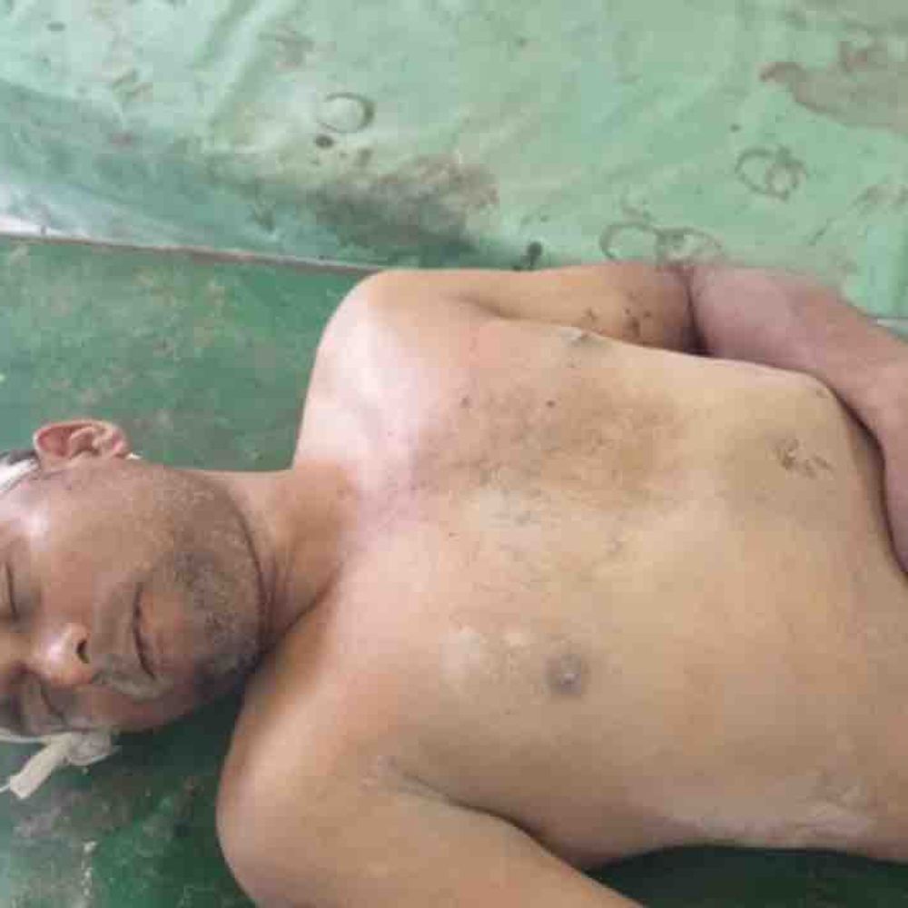 पहले मिला अधमरा, पहचान हुई तो अस्पताल से भागा:हंडिया के युवक की दारागंज थाने में गुमशुदगी थी दर्ज, अस्पताल से हुआ गायब