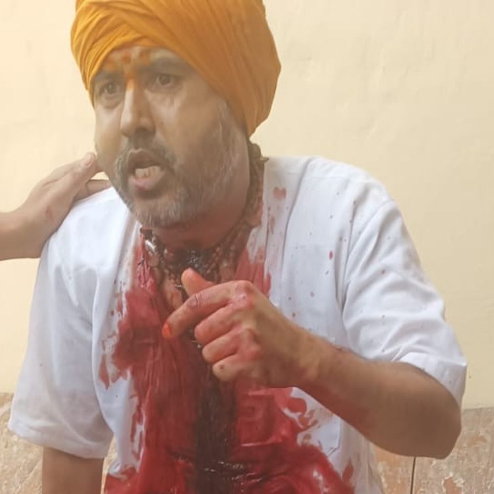 मथुरा के बरसाना में सेवायत पर जानलेवा हमला:अज्ञात हमलावरों ने किया, गंभीर हालत में अस्पताल में भर्ती