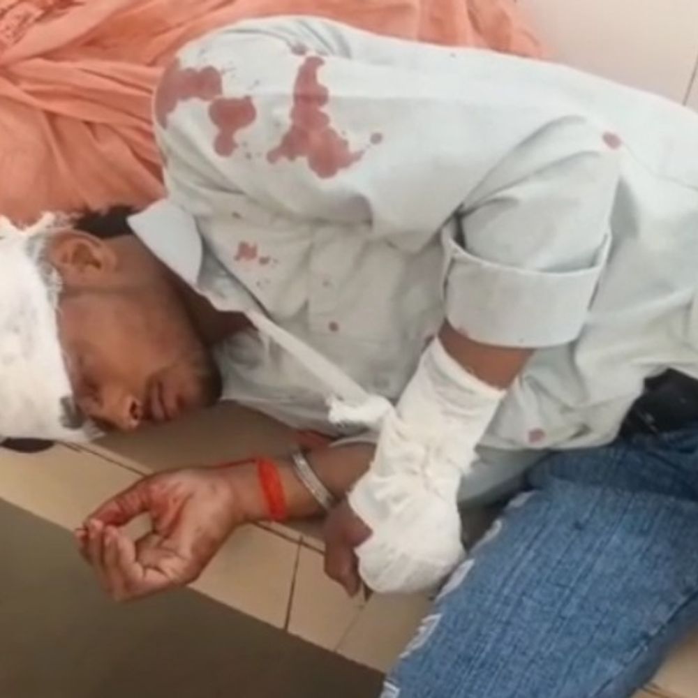 बाइक सवार को अज्ञात वाहन ने मारी टक्कर,युवक की मौत:देवरिया में चचेरे भाई की हालत गंभीर, मेडिकल कॉलेज रेफर