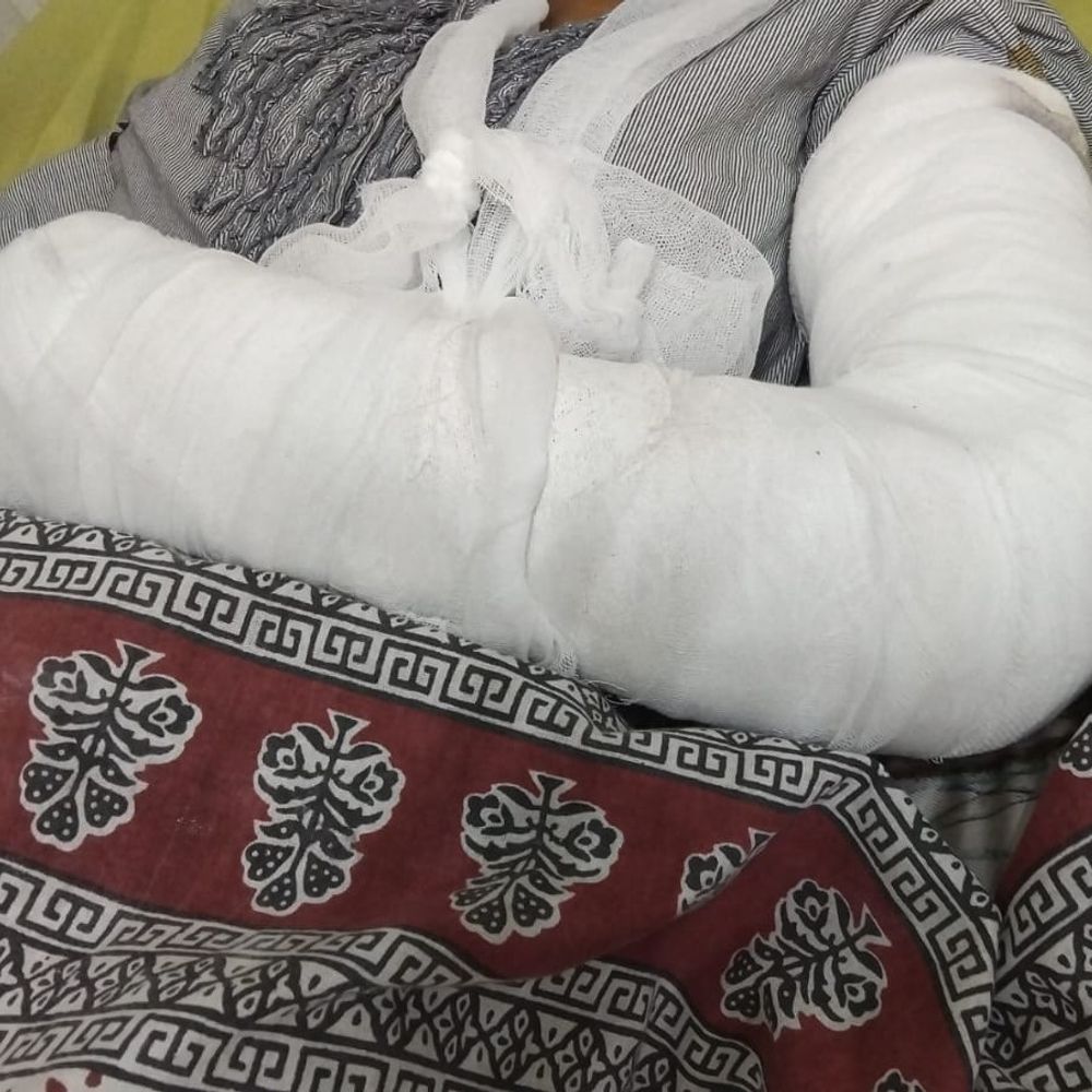 पंचकूला में ड्यूटी जा रही युवती हादसे में घायल:  रोड क्रॉस करते हुए बाइक ने मारी टक्कर; हाथ और पांव में फ्रेक्चर – Kalka News