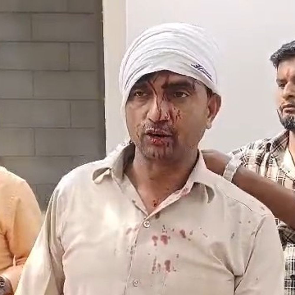 ब्लॉक परिसर में ग्राम प्रधान पर जानलेवा हमला:प्रधान के सिर में गंभीर चोट, पुलिस ने तीन आरोपी पकड़े