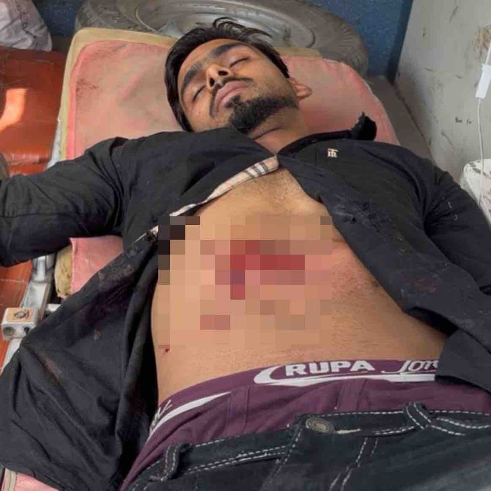 सोलन में दिनदहाड़े युवक को गोली मारी:  गंभीर हालत में PGI चंडीगढ़ रेफर; मां बोलीं- आपसी रंजिश में किया हमला – Nalagarh News