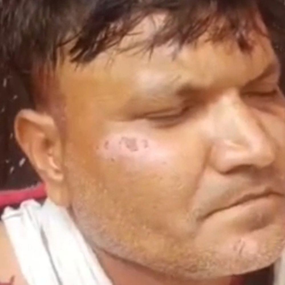 सुनार की दुकान पर नकली पिस्टल से लूट की कोशिश:आसपास के लोगों ने दौड़ाकर पकड़ा और पीटा, पुलिस ने हिरासत में लिया