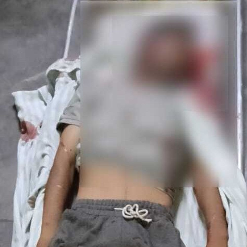 कार की टक्कर से भाई की मौत, बहन घायल:मेरठ में पुलिस भर्ती की तैयारी के लिए ग्राउंड में दौड़ लगाने जा रहे थे