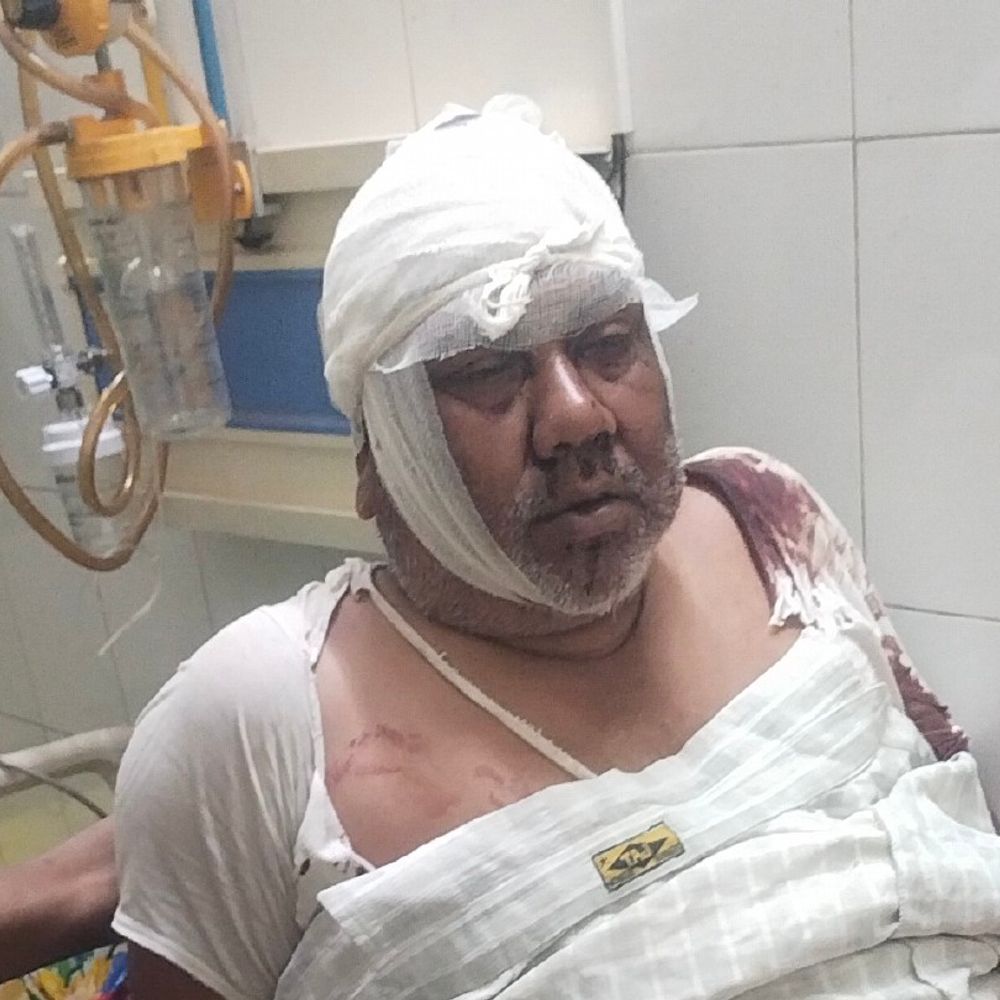 ललितपुर में राजीनामा के बाद पड़ोसी ने दामाद-ससुर को पीटा:बच्चों के विवाद में हुई मारपीट, दोनों घायल अस्पताल में भर्ती