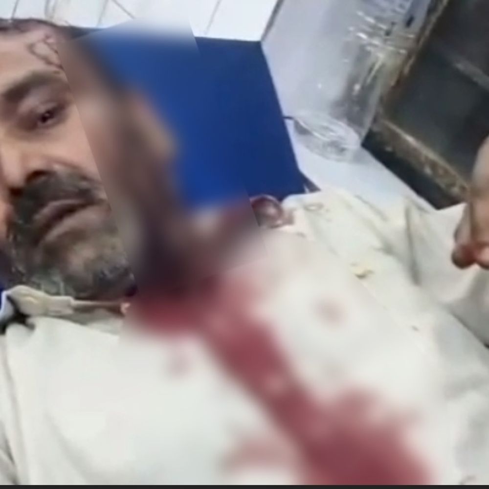 मुजफ्फरनगर में पिता-पुत्र पर किया हमला:दबंगों ने लाठी-डंडों से जमकर पीटा, दोनों गंभीर घायल