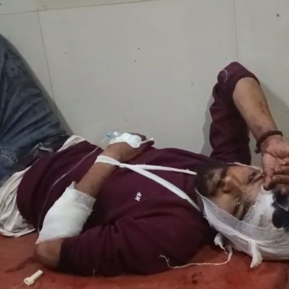 श्रावस्ती में सर्राफा व्यापारी पर जानलेवा हमला, लूट:नकाबपोश बाइक सवारों ने सोने के जेवर लूटे, पुलिस तलाश में जुटी