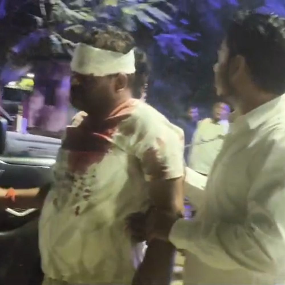 दो गुटों में झड़प, ग्राम प्रधान समेत 10 घायल:फतेहपुर में 21 लोगों पर केस, दो को गंभीर हालत में कानपुर रेफर किया गया