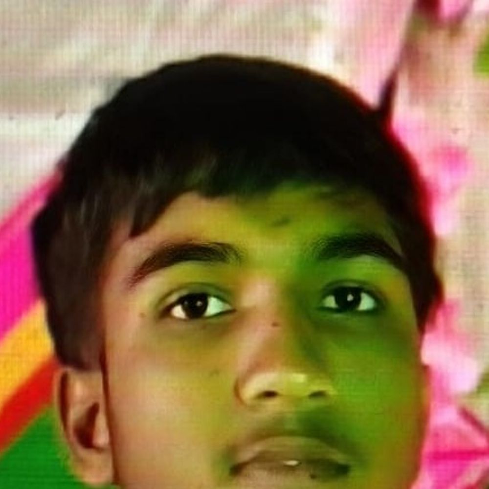 गोरखपुर में बाइक-ट्रॉली की टक्कर में छात्र की मौत:घायल युवक की इलाज के दौरान मौत, परिवार में पसरा मातम