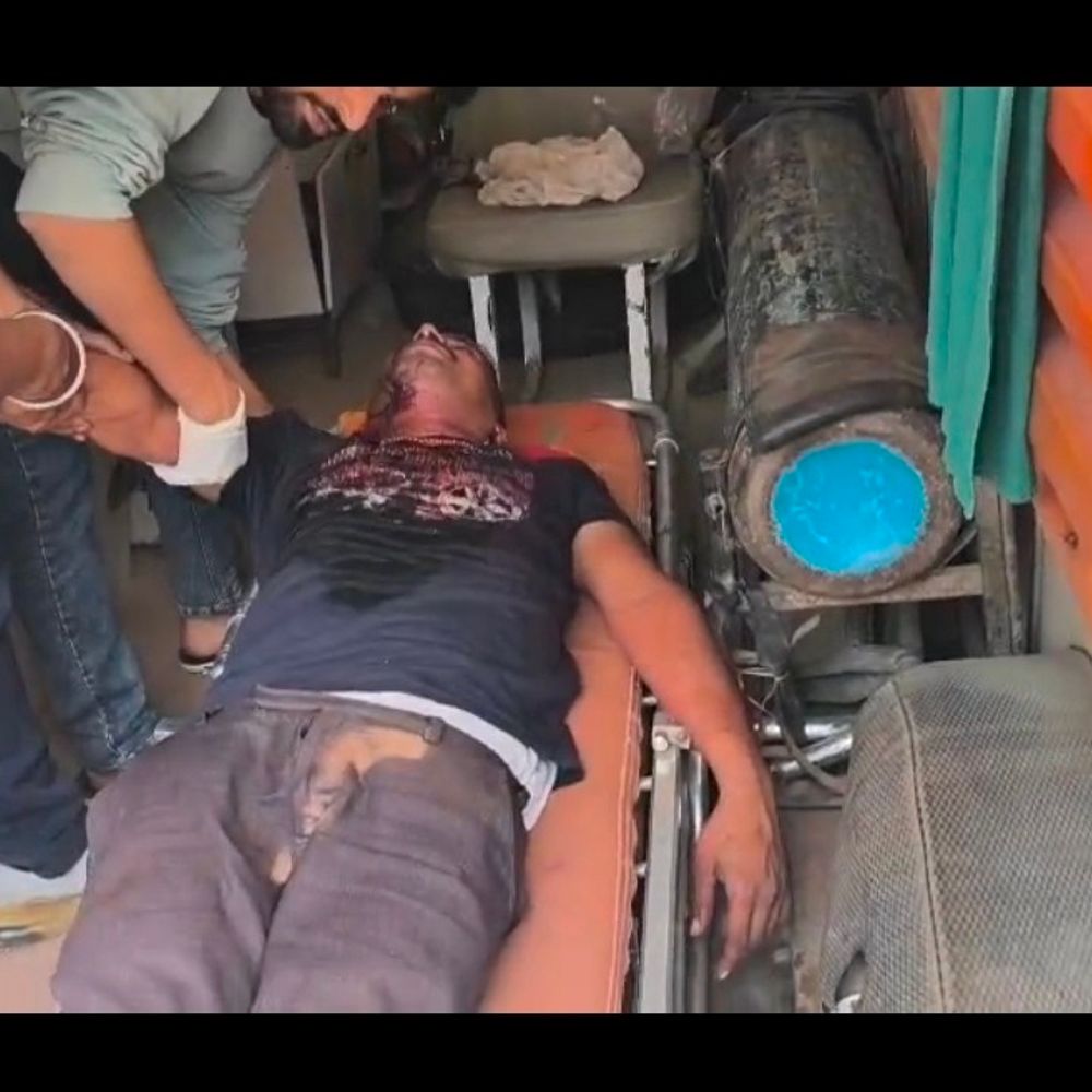 गोली मिस होने पर तमंचे की मुठिया से सिर फोड़ा:जौनपुर में पुरानी रंजिश में युवक पर फायरिंग, हालत गंभीर