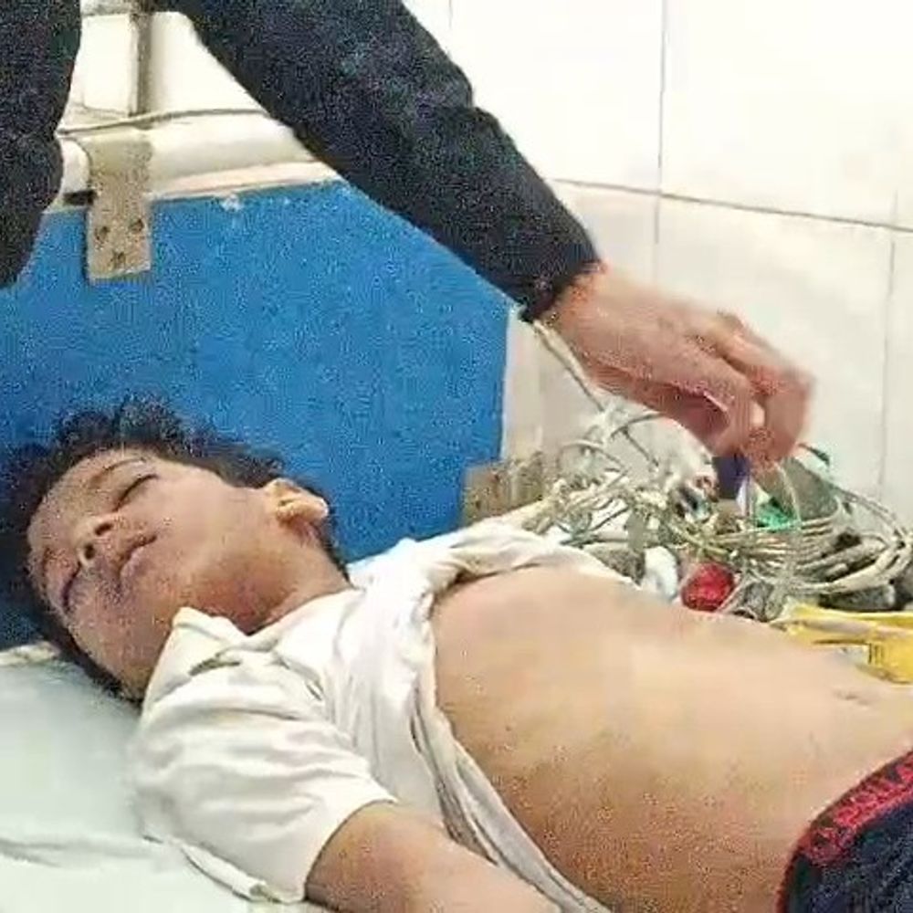 खेलते-खेलते गले में फंसा कूलर का तार, बच्चे की मौत:इटावा में हेड कांस्टेबल पिता ड्यूटी पर गए थे, मां बाथरूम में थी