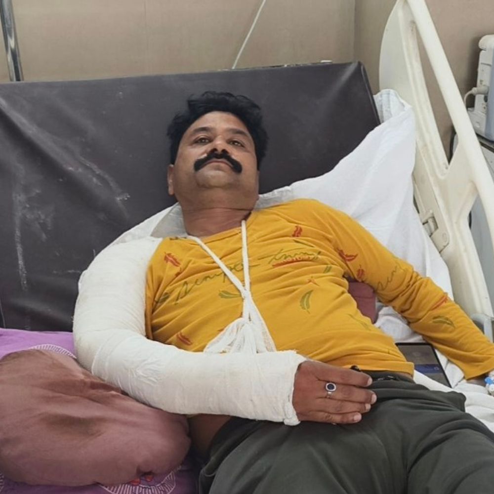 पाइप ले जा रही वाहन से टकराई बाइक, VIDEO:दतिया में एक युवक का हाथ फ्रैक्चर, उनाव रोड पर हादसा