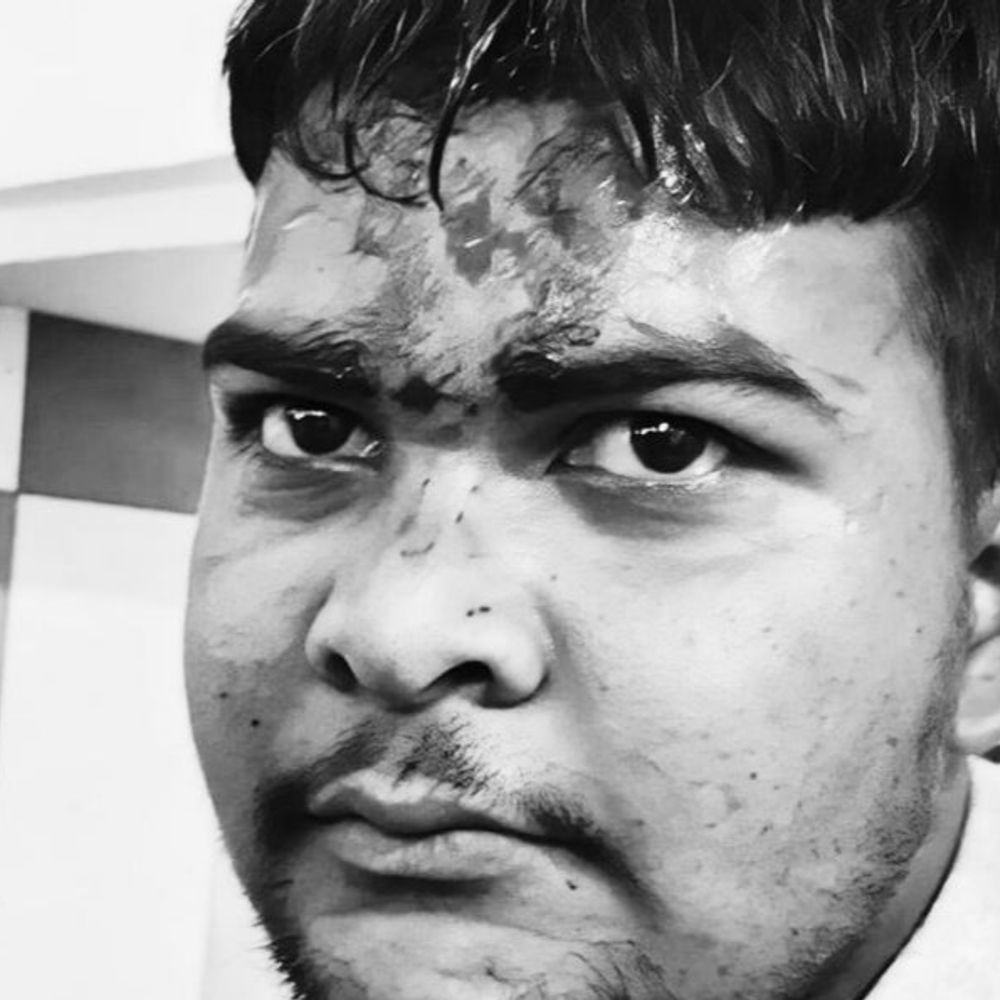 गैस सिलेंडर न मिलने पर एजेंसी कर्मचारी का सिर फोड़ा:एजेंसी के शीशे तोड़े, CCTV की मदद से आरोपियों पर की जा रही FIR