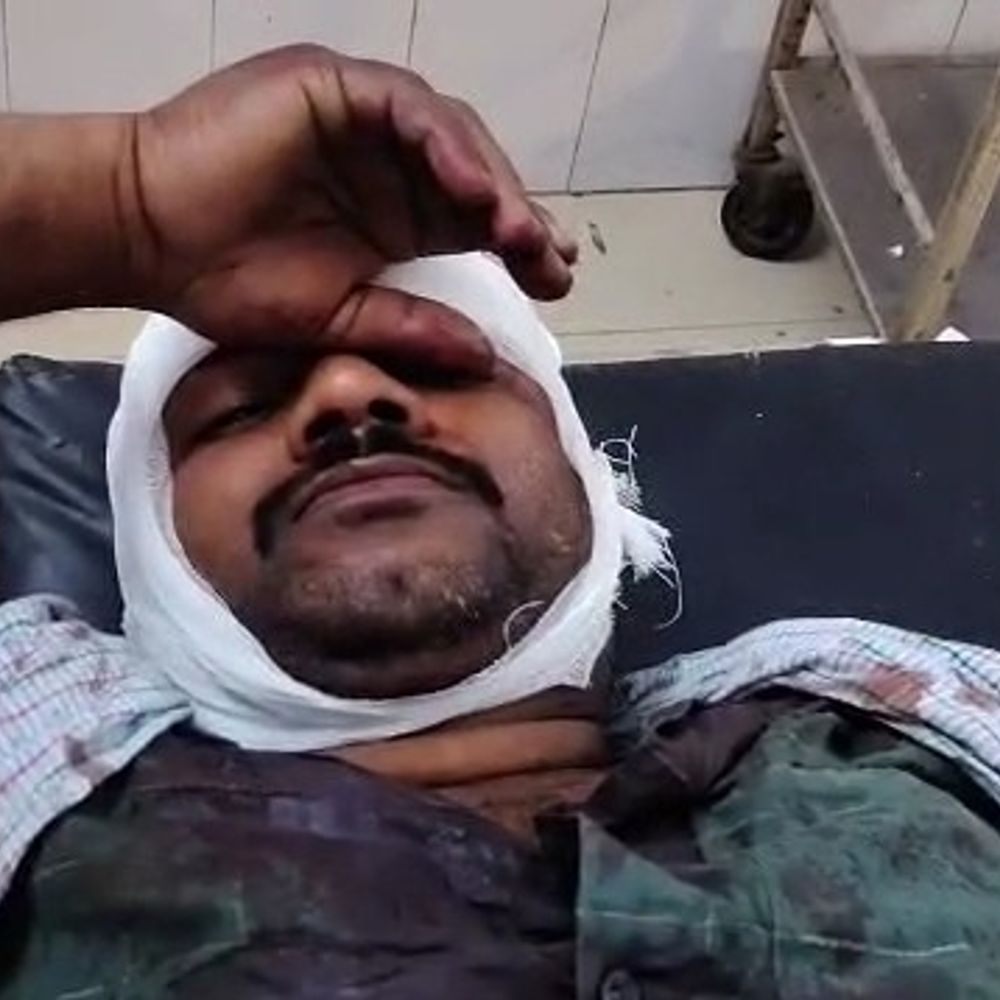 आजमगढ़ में जमीनी विवाद में भाइयों के बीच जमकर मारपीट:लोहे की रॉड और कुल्हाड़ी से किया गया हमला, दर्ज हुआ मुकदमा