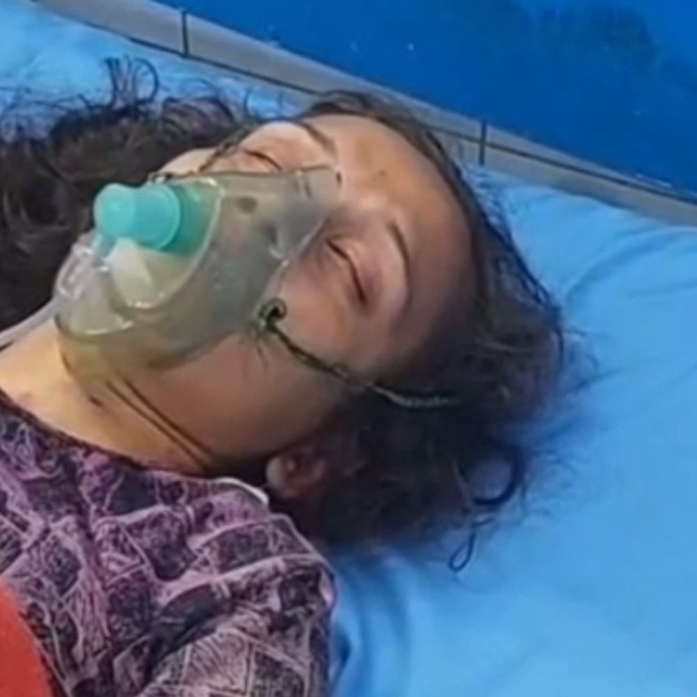 अम्बेडकरनगर में मधुमक्खियों का हमला, दो बहनें गंभीर घायल:जिला अस्पताल में भर्ती, ग्रामीणों ने प्रशासन से कार्रवाई की मांग की